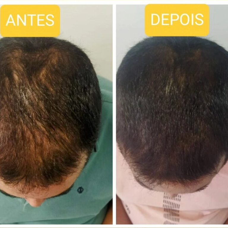 624605419_18052052189460345_9188454393710492806_n